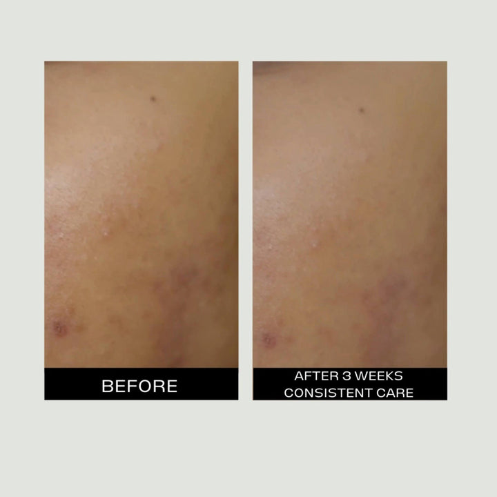 Rutina facial diaria y semanal del Set Premium de Meraki Healthy Selfcare