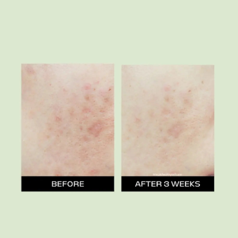 Open view of the Meraki Healthy Luxury Skincare Box, featuring handcrafted organic skincare products made with pure botanical ingredients for hydration, radiance, and nourishment