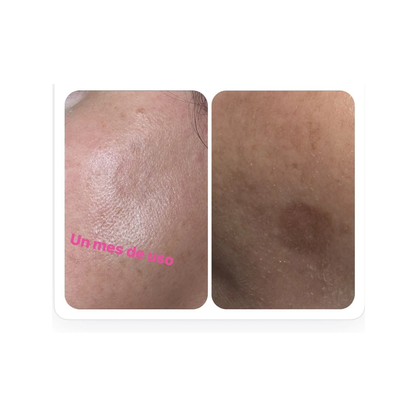 Dark Spot + Hydration Starter Set